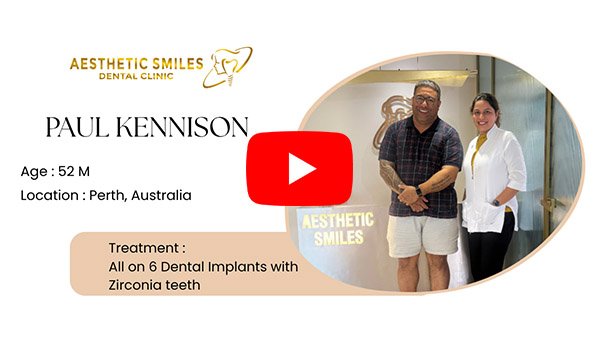 Australian patient testimonial video thumbnail