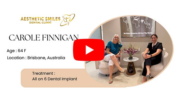 Carrol's patient testimonial video thumbnail