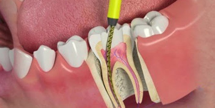 other dental treatments