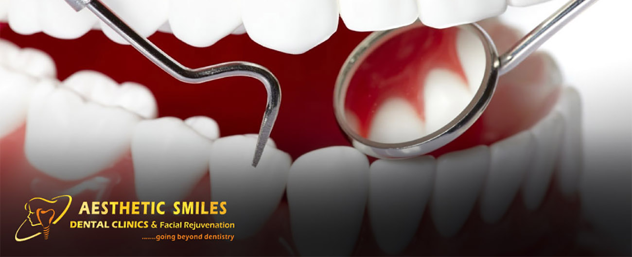 THE IMPORTANCE OF ORAL HYGIENE - know from one of the best dentist in Mumbai 