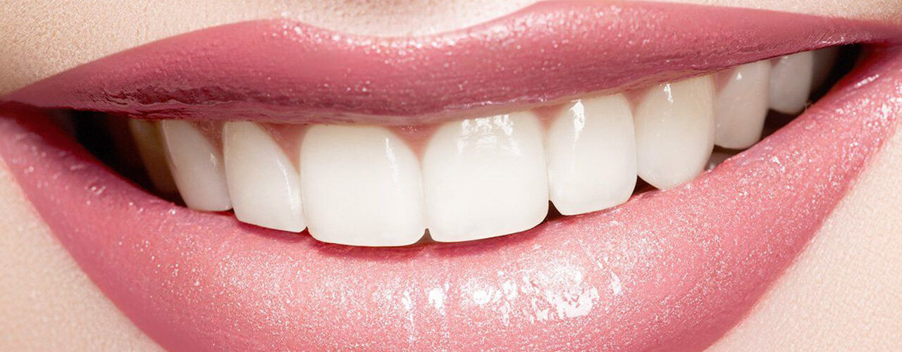 Myths of teeth whitening treatment