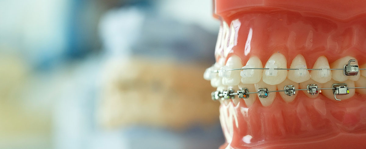 Step-by-Step Guide: What to Expect From Orthodontic Treatment