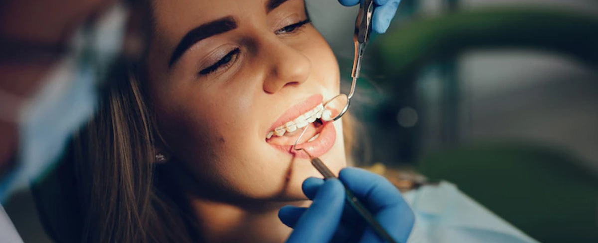 Why You Should Visit the Dentist Every 6 Months