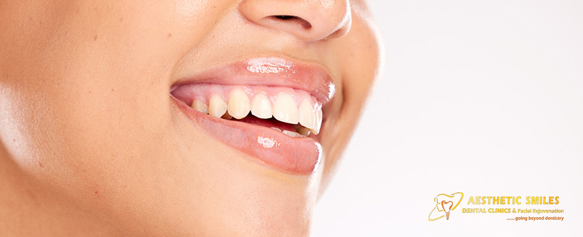 The Complete Guide to Smile Makeovers in Mumbai, India