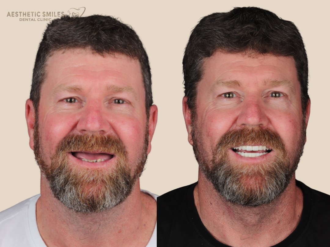 before-after-case-2 before-after-case-2