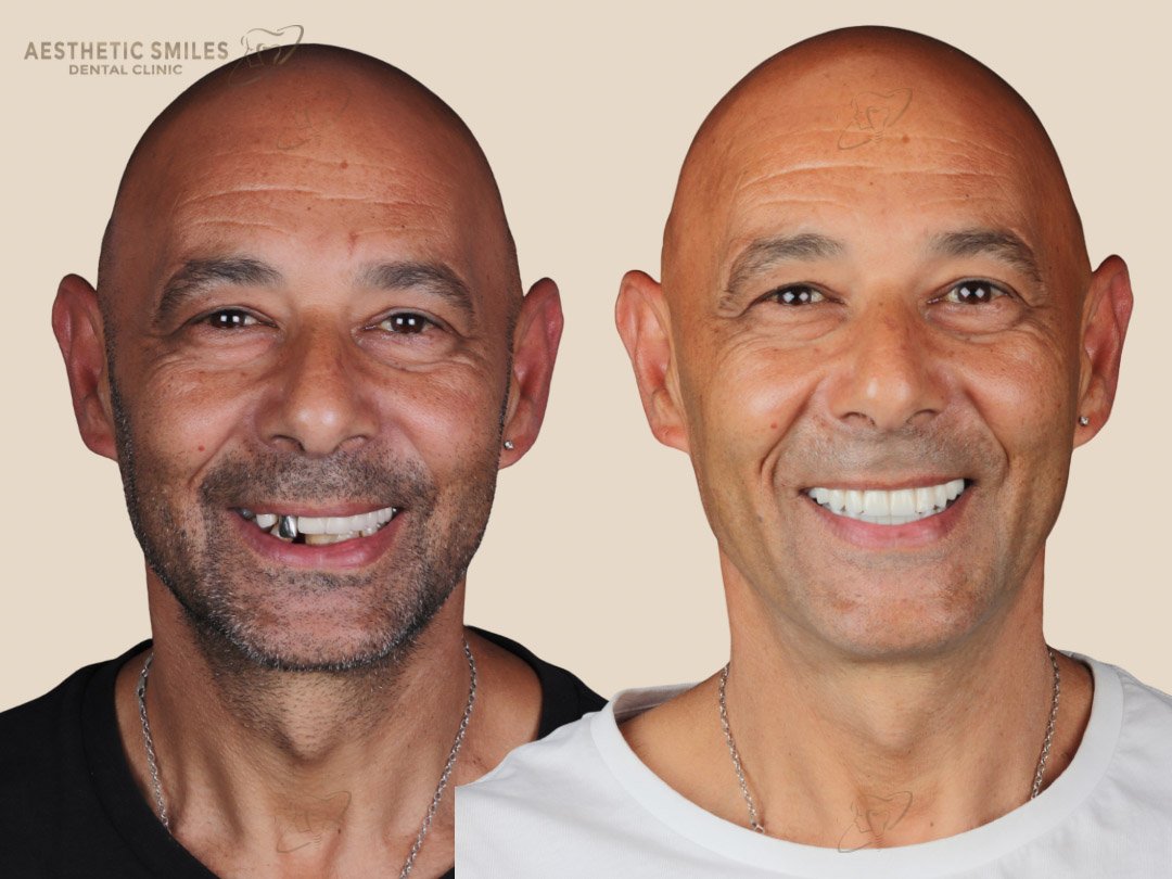before-after-case-3 before-after-case-3
