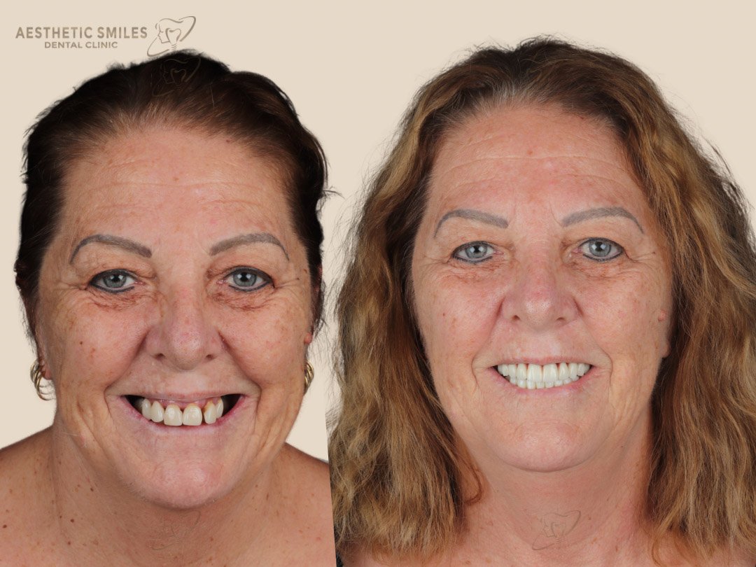 before-after-case-4 before-after-case-4