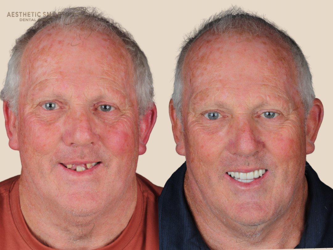 before-after-case-5 before-after-case-5