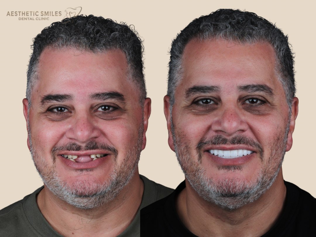 before-after-case-6 before-after-case-6