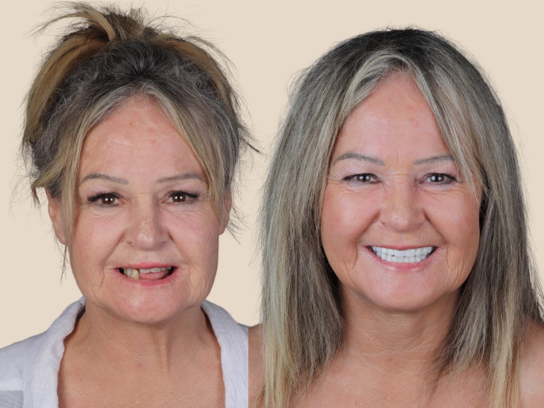 before-after-case-7 before-after-case-7